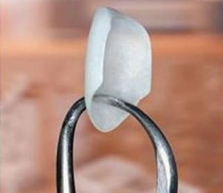Close-up photo of the tip of dental forceps holding a single porcelain veneer, for a comparison of Lumineers with other brands, from Poplar Crossing Dental, the office of Dr. Williams Becker in Hoffman Estates.