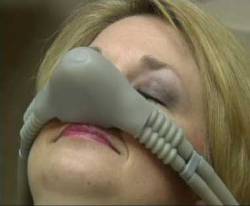 An image of a woman with a nitrous oxide nose piece. 
